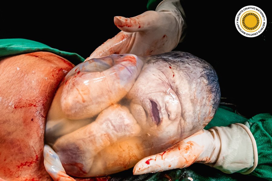 Maiores Médias – Instinto Maternity- Categoria: Parto – 1° Round 2026
